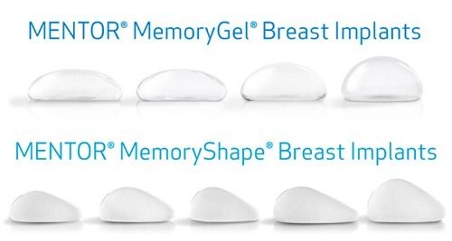 Nâng ngực giọt nước: Tất tần tật những điều cần biết về phương pháp