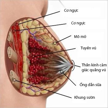 Nâng ngực mổ hở nếp dạ vú