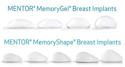 Túi ngực Mentor giọt nước được nhiều người lựa chọn