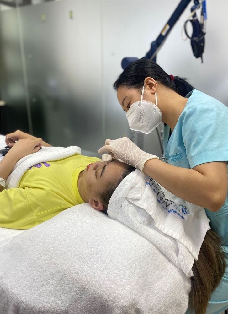 Trị mụn trứng cá bằng Laser Fractional CO2