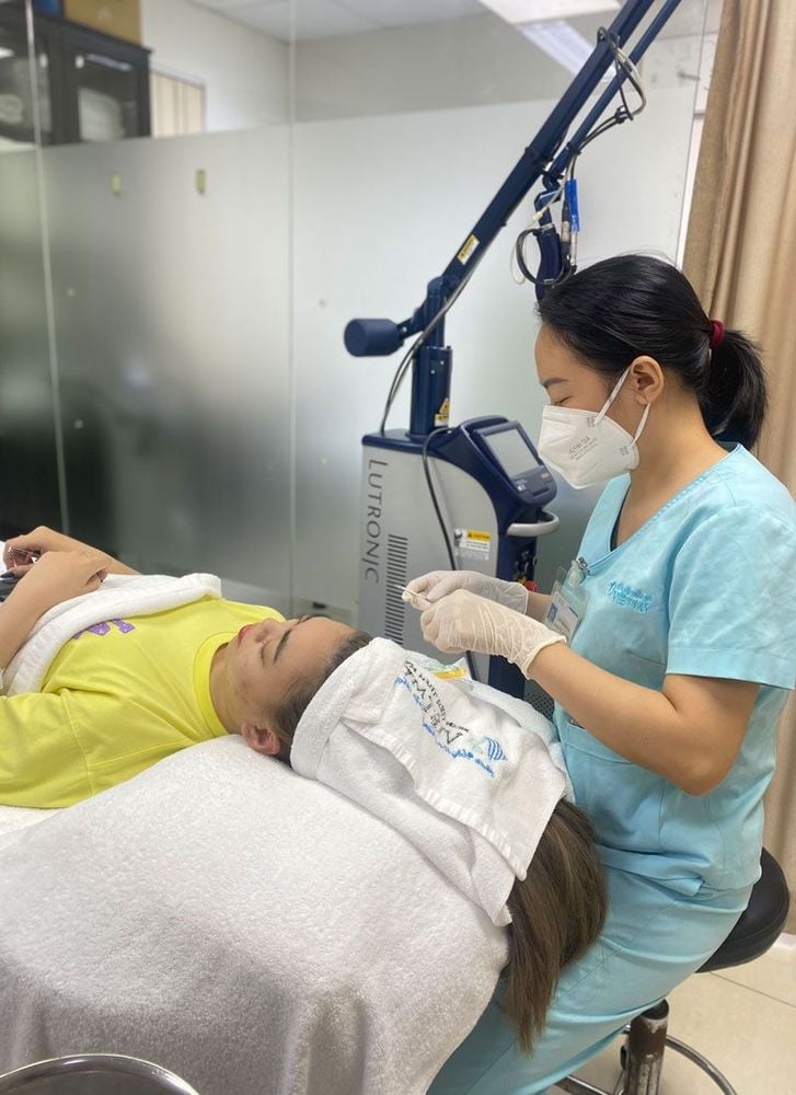 Trị mụn trứng cá bằng Laser Fractional CO2