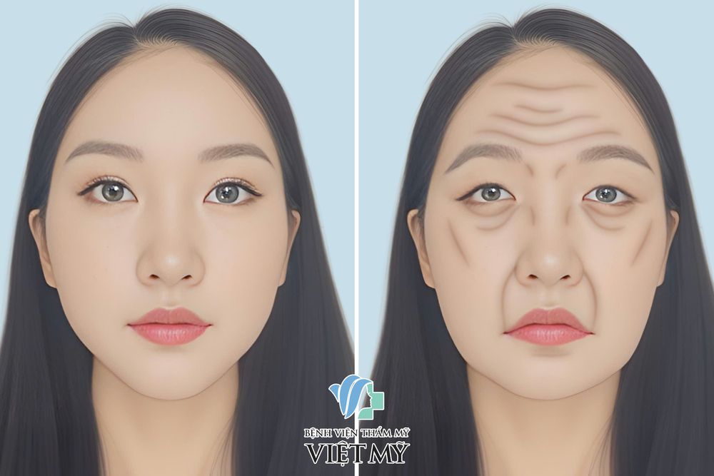 Mô phỏng sự lão hóa vùng mặt
