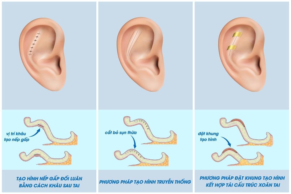 Các phương pháp điều trị