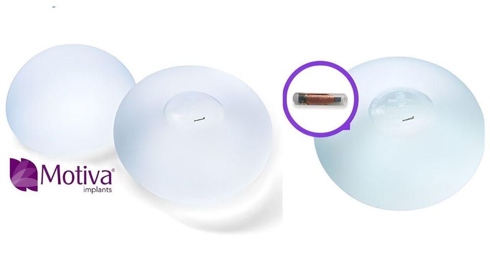 Túi ngực Nano Chip được tích hợp vi chip điện tử thông minh