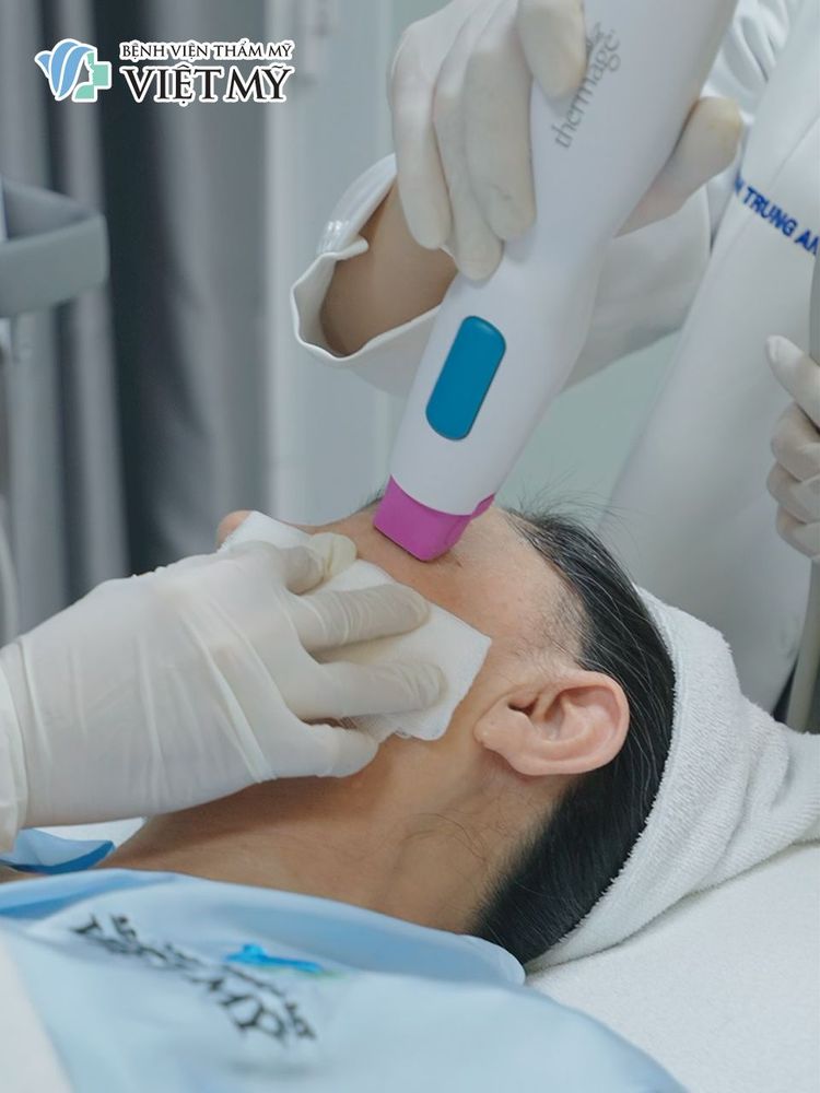 Làm Thermage FLX một lần hiệu quả duy trì được bao lâu?