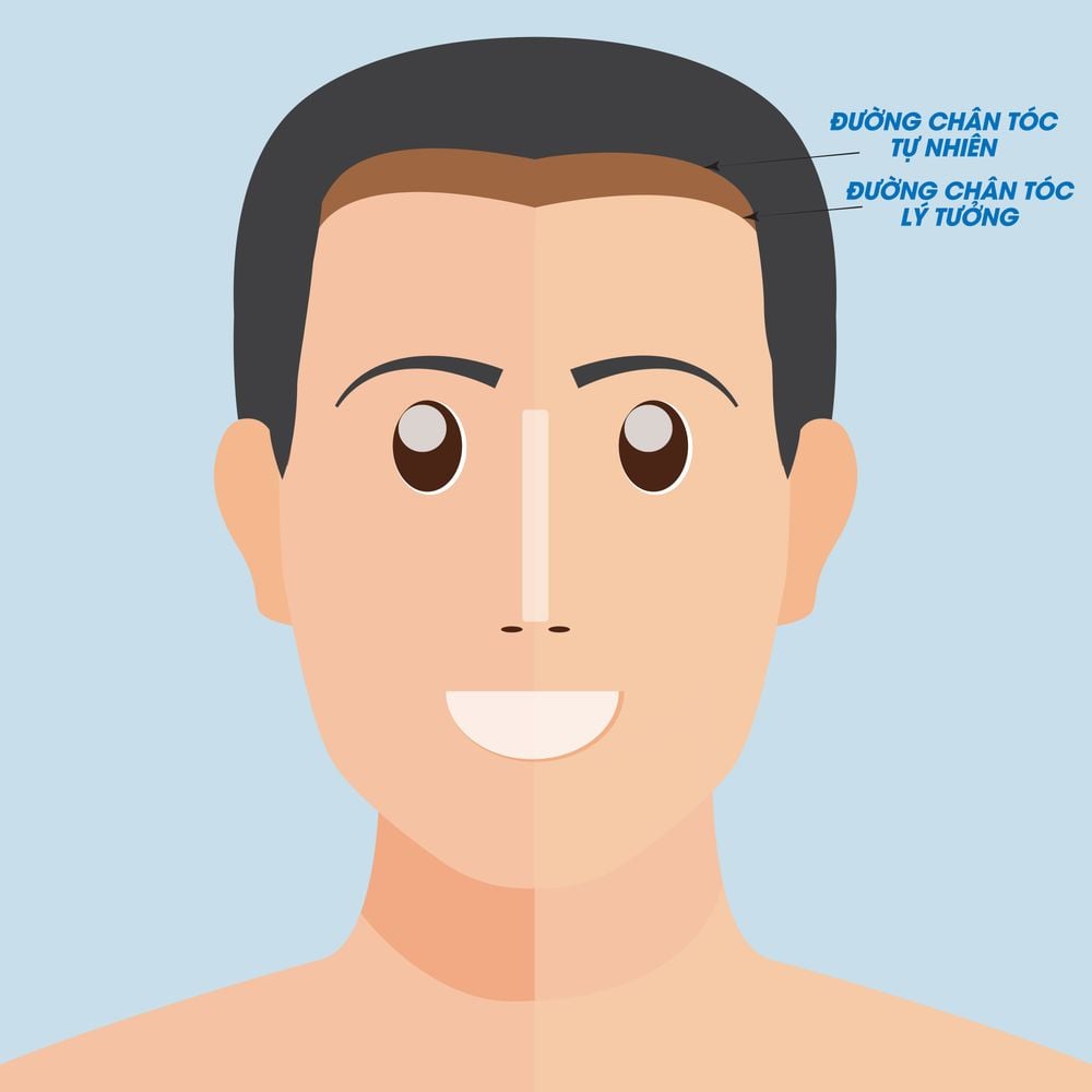đường chân tóc tự nhiên