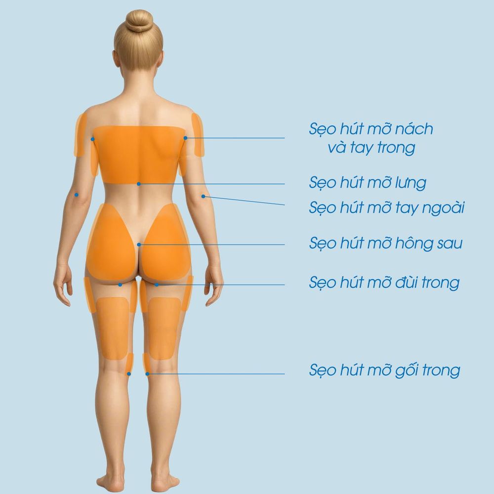 mô phỏng hút mỡ đùi, bụng, tay, nách