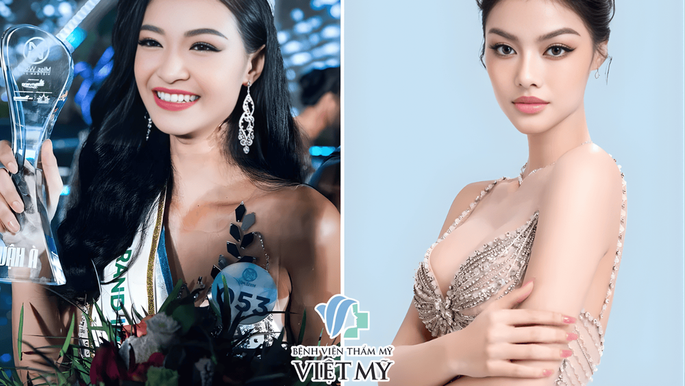 Khi dáng ngực thay đổi theo thời gian, bạn có thể cân nhắc nâng ngực lần 2 để bầu ngực cân đối và mềm mại hơn.