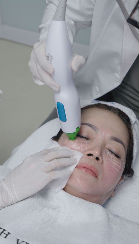 Thermage FLX là gì? Vì sao hàng triệu người lựa chọn để trẻ hóa da không phẫu thuật?