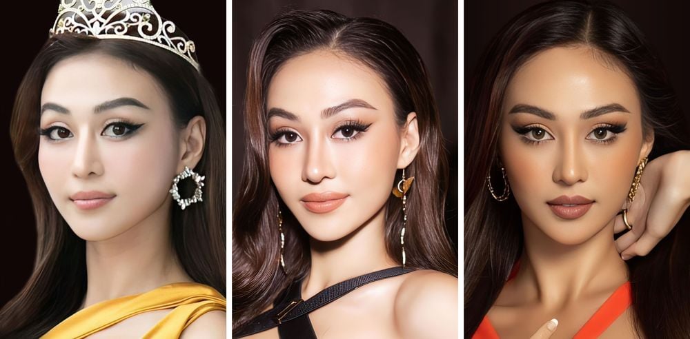 Á hậu Tuyết Như sau nâng mũi S Line.