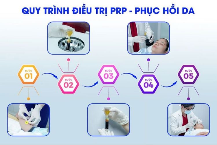 PRP Huyết tương giàu tiểu cầu phục hồi, trẻ hóa da