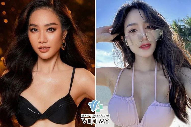 Nâng ngực chảy xệ là giải pháp thẩm mỹ phù hợp với khách hàng từ 18 tuổi trở lên khi cơ thể đã phát triển hoàn thiện.