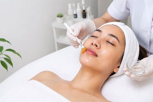Tái tạo da bằng hóa chất (CHEMICAL PEEL)