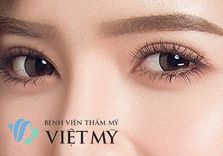 Bấm mí Hàn Quốc - Nhấn mí mắt - bác sĩ Chiêm Quốc Thái - Nhấn mắt 2 mí