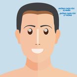 Phẫu thuật hạ đường chân tóc