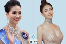 Hình trước sau nâng ngực mổ hở quầng vú